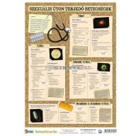   Szexuális úton terjedő betegségek, vírusok fixi tanulói munkalap 